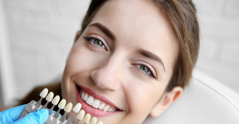 What’s the Difference Between Bonding and Veneers?