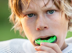 5 Benefits of a Professionally Fitted Mouthguard
