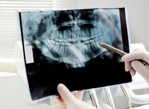 restorative dentistry | dental x ray
